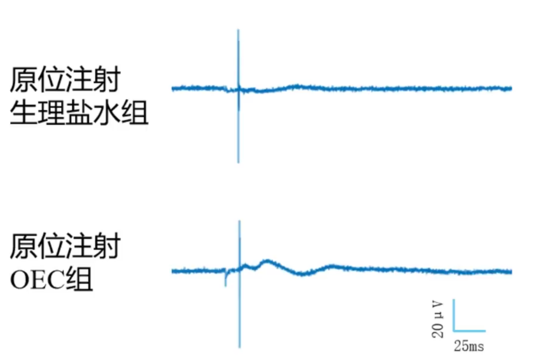 生理盐水组与OEC组运动诱发电位波形对比